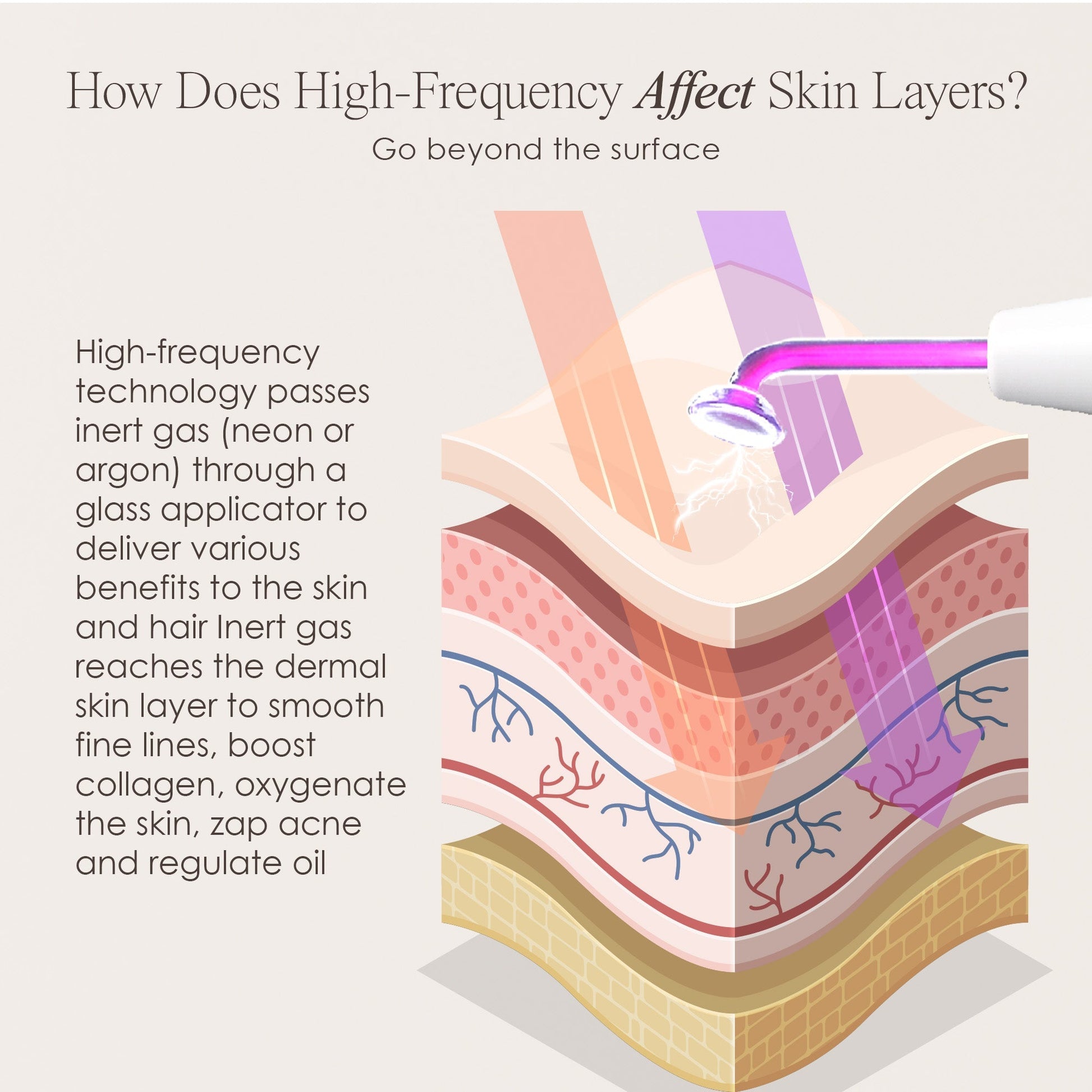 Clinical High-Frequency Wand