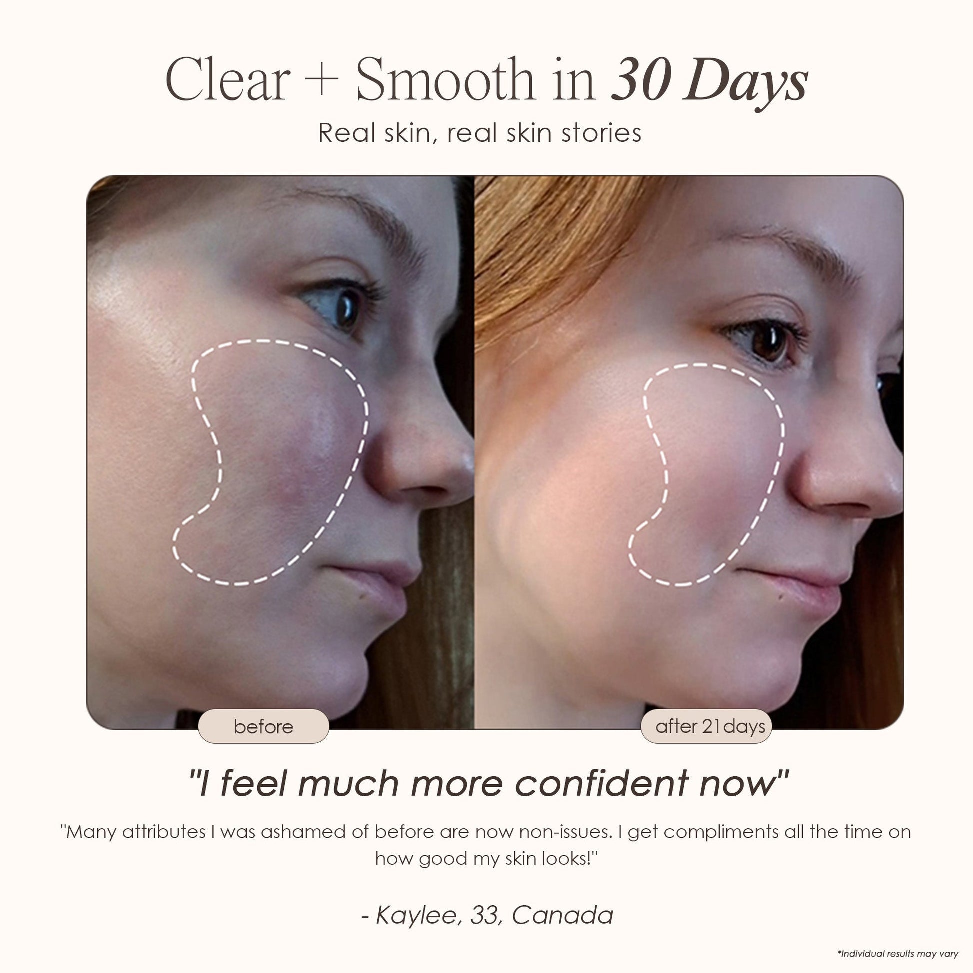 Clinical High-Frequency Wand